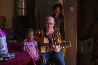 Living with albinism in Mozambique